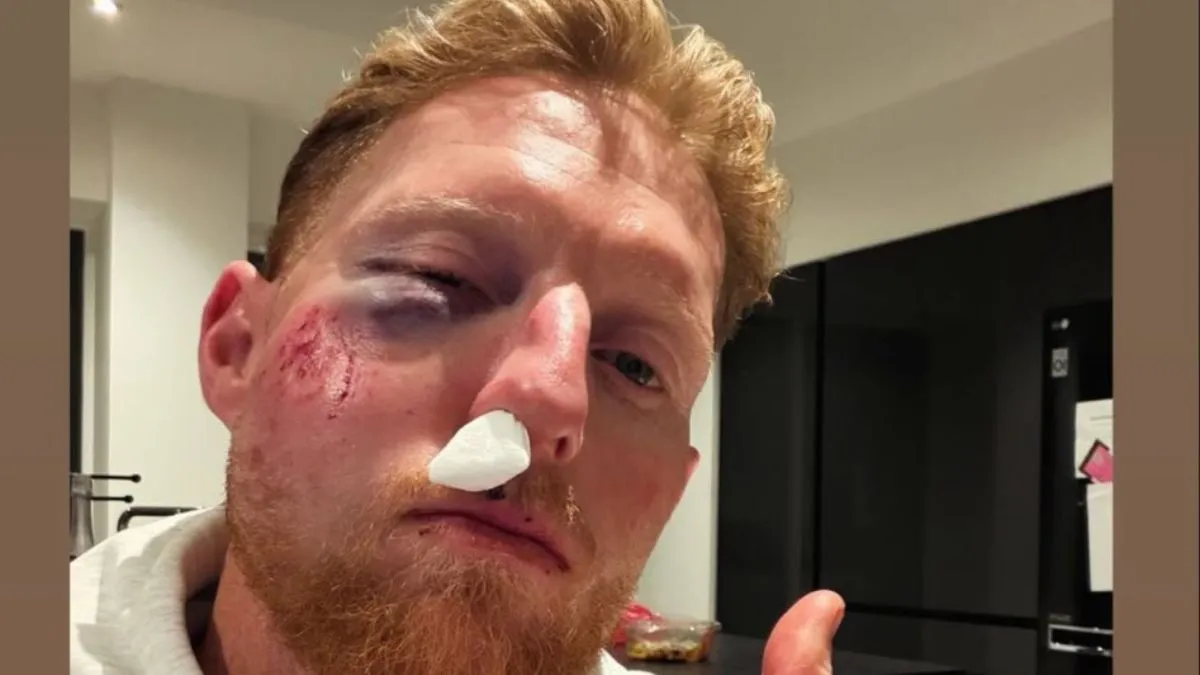 Ben Stokes posts a picture of his horrific injury on social media.